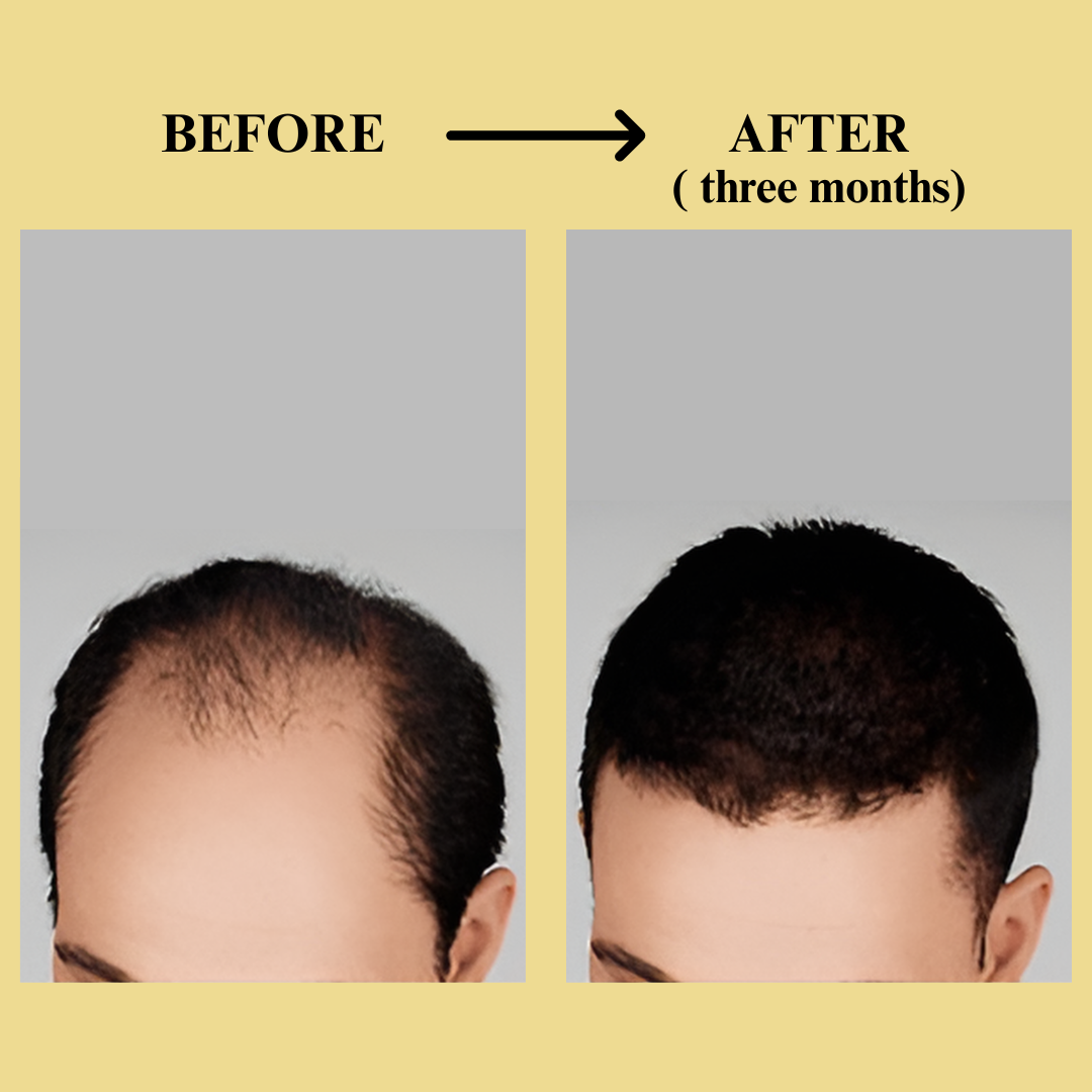 Herbanic Hair Growth Serum™