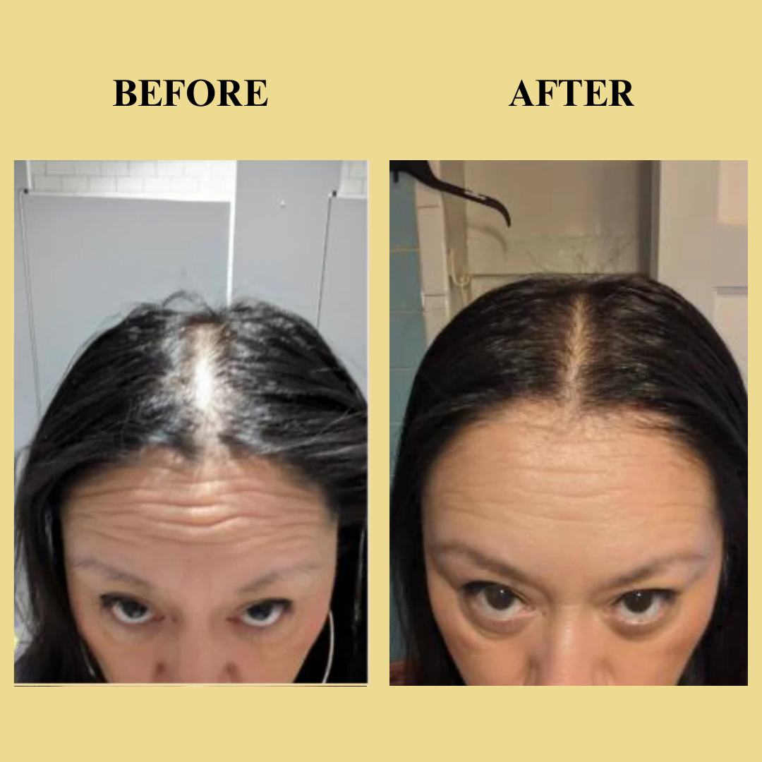 Herbanic Hair Growth Serum™